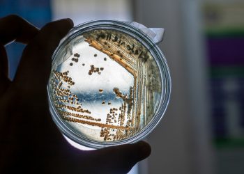 Un’innovazione vitale (per noi)